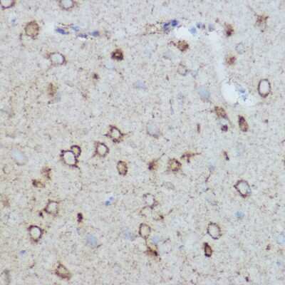 Immunohistochemistry-Paraffin: MT-CO2 Antibody - BSA Free [NBP2-94441]