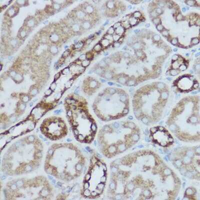 Immunohistochemistry-Paraffin: MT-CO2 Antibody - BSA Free [NBP2-94441]