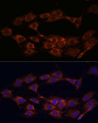 Immunocytochemistry/ Immunofluorescence: MT-ND1 Antibody - Azide and BSA Free [NBP2-94462]