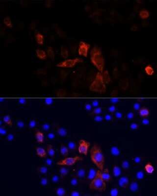 Immunocytochemistry/ Immunofluorescence: MT-ND2 Antibody - Azide and BSA Free [NBP3-05589]