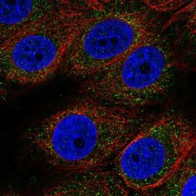 Immunocytochemistry/ Immunofluorescence: MT-ND3 Antibody [NBP2-38021]
