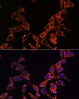 Immunocytochemistry/ Immunofluorescence: MT-ND4 Antibody - Azide and BSA Free [NBP2-93530]