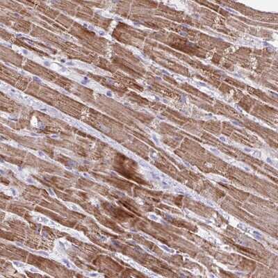 Immunohistochemistry-Paraffin: MT-ND4 Antibody [NBP2-47365]