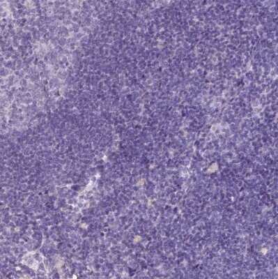 Immunohistochemistry-Paraffin: MT-ND4 Antibody [NBP2-47365]