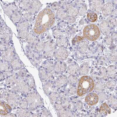 Immunohistochemistry-Paraffin: MT-ND4 Antibody [NBP2-47365]