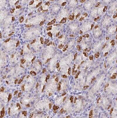 Immunohistochemistry-Paraffin: MT-ND4 Antibody [NBP2-47365]