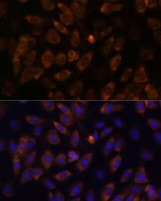Immunocytochemistry/ Immunofluorescence: MT-ND4L Antibody - Azide and BSA Free [NBP3-05239]