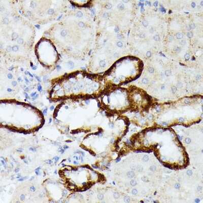 Immunohistochemistry-Paraffin: MT-ND5 Antibody - Azide and BSA Free [NBP3-05604]