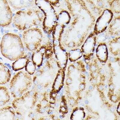Immunohistochemistry-Paraffin: MT-ND5 Antibody - Azide and BSA Free [NBP3-05604]