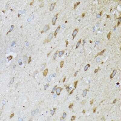 Immunohistochemistry-Paraffin: MT-ND5 Antibody - BSA Free [NBP3-05606]