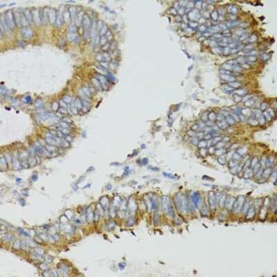 Immunohistochemistry-Paraffin: MT-ND5 Antibody - BSA Free [NBP3-05606]