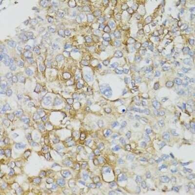 Immunohistochemistry-Paraffin: MT-ND5 Antibody - BSA Free [NBP3-05606]