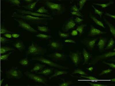 Immunocytochemistry/ Immunofluorescence: MTA1 Antibody (1C3) [H00009112-M10]