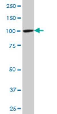Western Blot: MTA1 Antibody (1C3) [H00009112-M10]