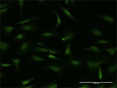 Immunocytochemistry/ Immunofluorescence: MTA1 Antibody (2D4) [H00009112-M03]