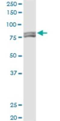 Western Blot: MTA1 Antibody (2D4) [H00009112-M03]