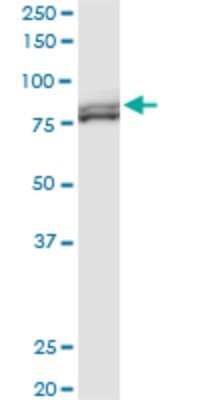 Western Blot: MTA1 Antibody (2D4) [H00009112-M03]