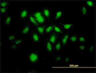 Immunocytochemistry/ Immunofluorescence: MTA1 Antibody (4D11) [H00009112-M02]
