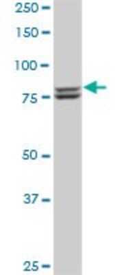 Western Blot: MTA1 Antibody (4D11) [H00009112-M02]