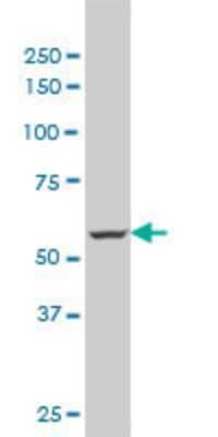 Western Blot: MTA1 Antibody (4D11) [H00009112-M02]
