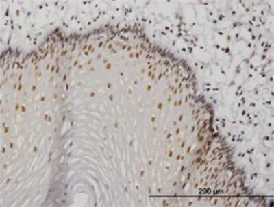 Immunohistochemistry-Paraffin: MTA1 Antibody (4D5) [H00009112-M01]