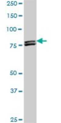 Western Blot: MTA1 Antibody (4D5) [H00009112-M01]