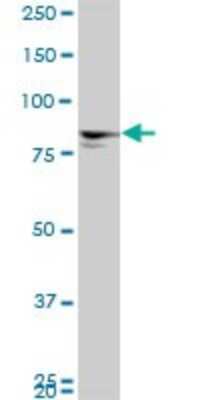 Western Blot: MTA1 Antibody (4D5) [H00009112-M01]