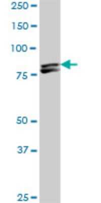 Western Blot: MTA1 Antibody (4D5) [H00009112-M01]