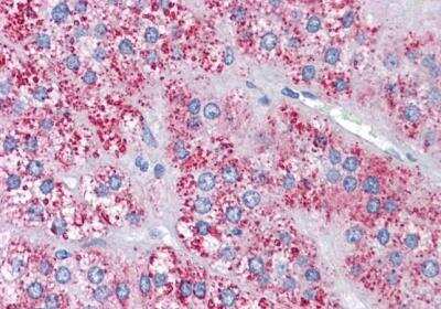 Immunohistochemistry-Paraffin: MTA1 Antibody [NB100-823]