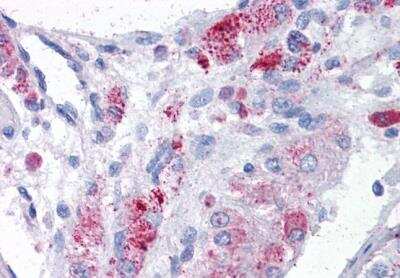 Immunohistochemistry-Paraffin: MTA1 Antibody [NB100-823]