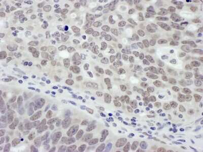 Immunohistochemistry-Paraffin: MTA1 Antibody [NB600-260]
