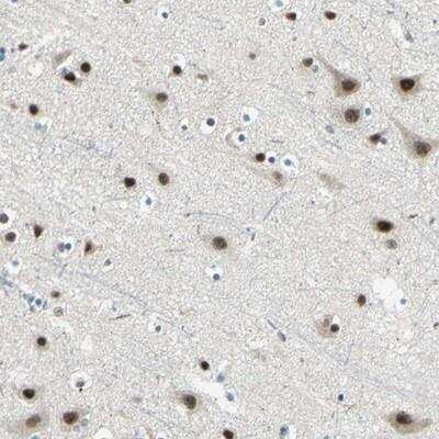 Immunohistochemistry-Paraffin: MTA1 Antibody [NBP1-89467]