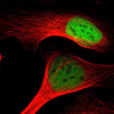 Immunocytochemistry/ Immunofluorescence: MTA2 Antibody [NBP1-82615]