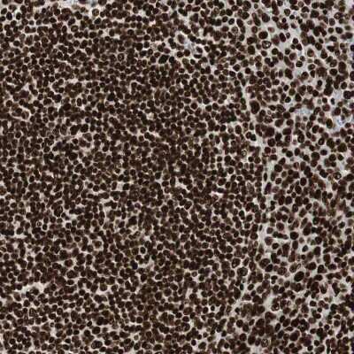 Immunohistochemistry-Paraffin: MTA2 Antibody [NBP1-82615]