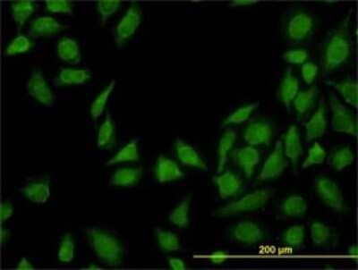 Immunocytochemistry/ Immunofluorescence: MTAP Antibody (2G4) [H00004507-M01]