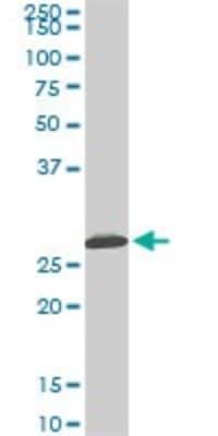 Western Blot: MTAP Antibody (2G4) [H00004507-M01]