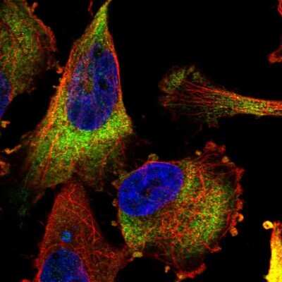 Immunocytochemistry/ Immunofluorescence: MTAP Antibody [NBP2-56796]