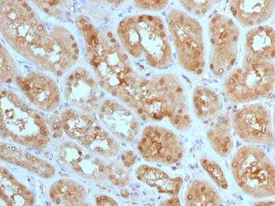 Immunohistochemistry-Paraffin: MTAP Antibody (MTAP/1813) - Azide and BSA Free [NBP2-75731]