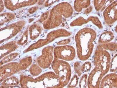 Immunohistochemistry-Paraffin: MTAP Antibody (MTAP/3137R) - Azide and BSA Free [NBP3-08965]