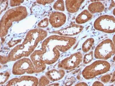 Immunohistochemistry-Paraffin: MTAP Antibody (MTAP/3137R) - Azide and BSA Free [NBP3-08965]