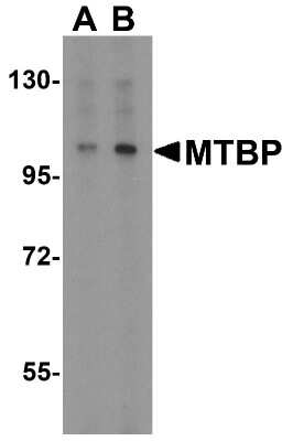 Western Blot: MTBP AntibodyBSA Free [NBP1-76747]