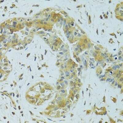Immunohistochemistry-Paraffin: MTCH1 Antibody - BSA Free [NBP2-93766]