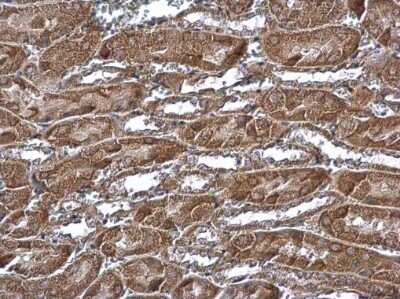 Immunohistochemistry-Paraffin: MTCH2 Antibody [NBP3-12914]