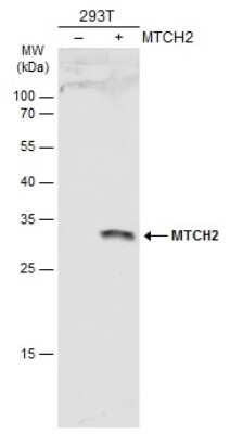 Western Blot: MTCH2 Antibody [NBP3-12914]