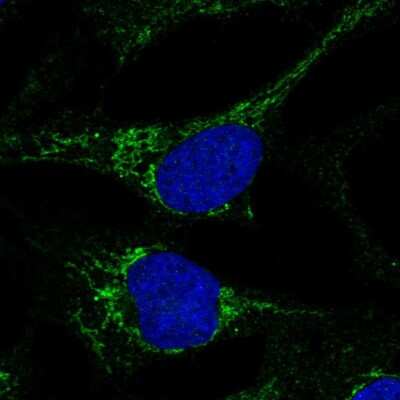 Immunocytochemistry/ Immunofluorescence: MTCP1NB Antibody [NBP1-93450]