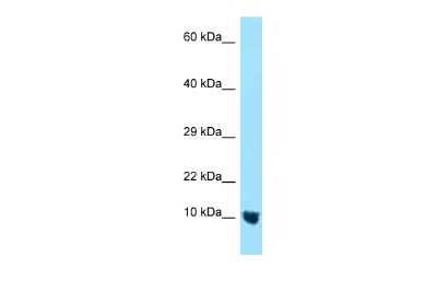 Western Blot: MTCP1NB Antibody [NBP2-83237]