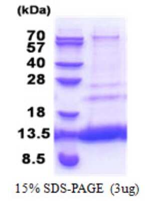 SDS-PAGE: Recombinant Human MTCP1NB His Protein [NBP2-22969]
