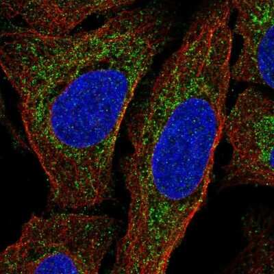 Immunocytochemistry/ Immunofluorescence: MTERF Antibody [NBP2-57353]