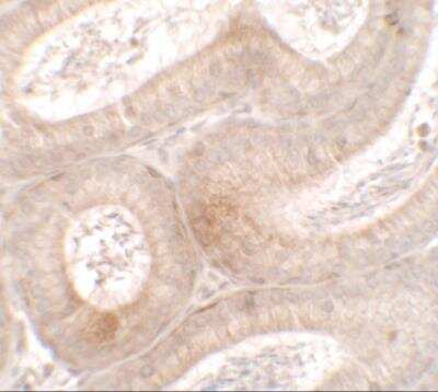 Immunohistochemistry: MTERFD3 Antibody - BSA Free [NBP2-81741]