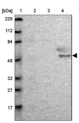 Western Blot: MTERFD3 Antibody [NBP1-82241]